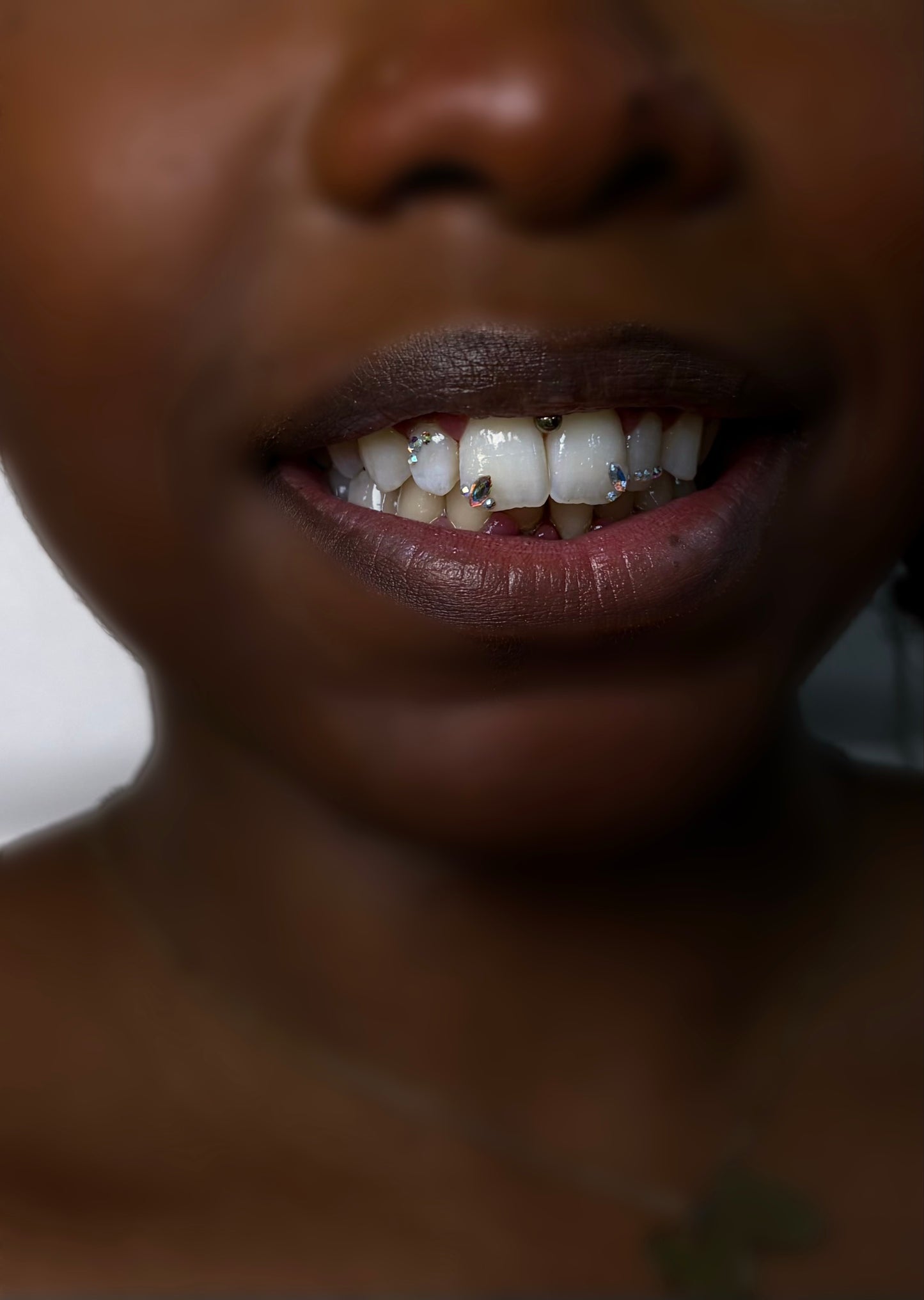 Formation Technicien GEMS dentaire (1 jour)